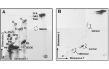Lipid metabolism of the parasite Toxoplasma gondii: Evidence of a different origin of the fatty acids according to the parasitic stage
