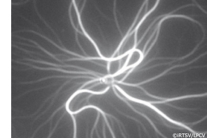 Dynamique stochastique des filaments d'actine
