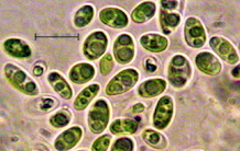 A new radioresistant microalgae