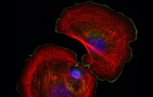 Migration cellulaire : découverte d’une protéine frein et volant de la cellule
